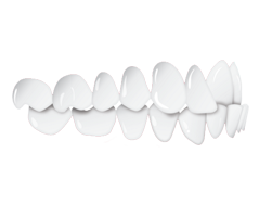 cross bite